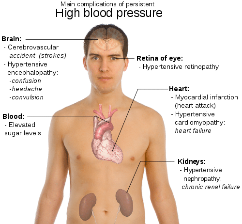Symptoms of High blood pressure