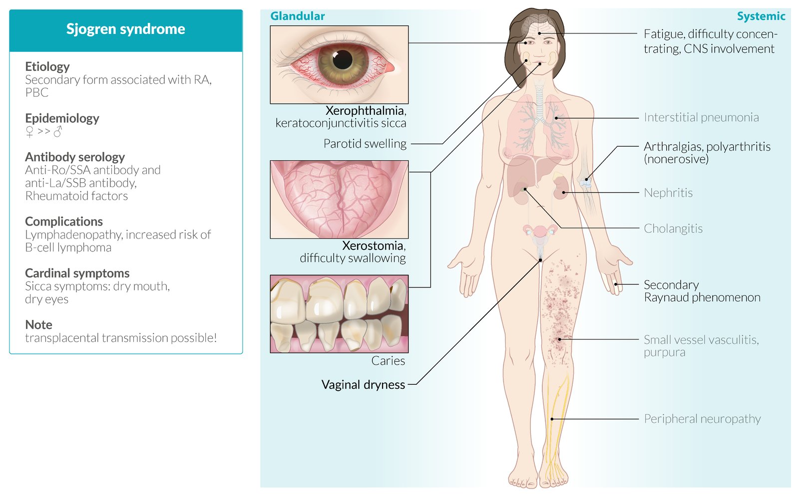 Treatment For Sjogren S Syndrome Philadelphia Holistic Clinic Dr Tsan