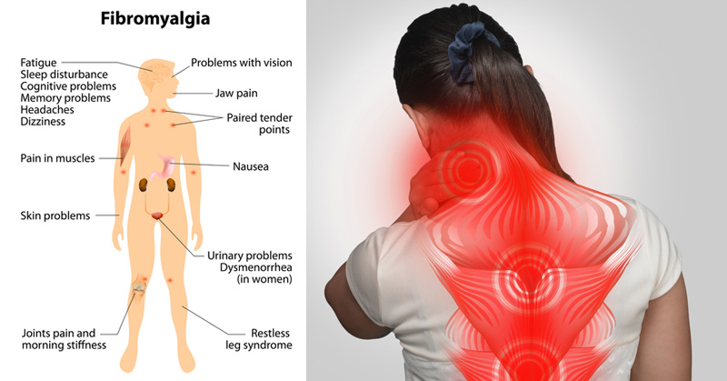 Natural remedies for fibromyalgia help to tolerate pain