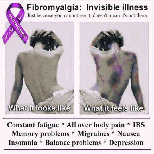 Use natural remedies for fibromyalgia to diminish symptoms