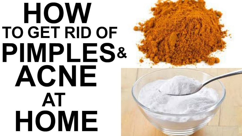 Home Remedies for Acne