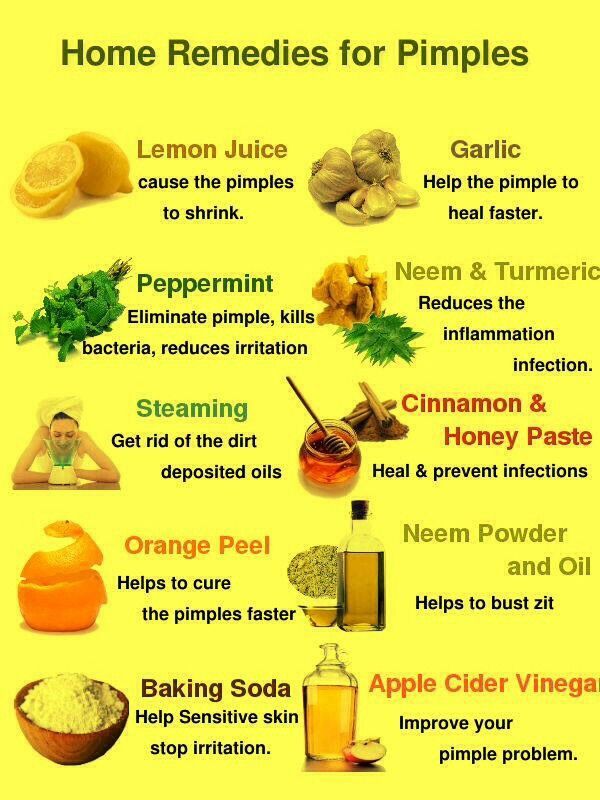 Home Remedies for Acne