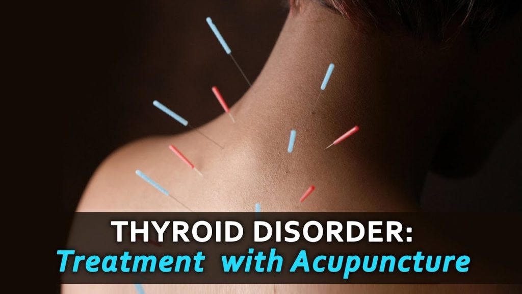 Natural remedies for thyroid problems - Acupuncture for thyroid problems 