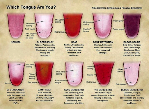 Tongue Diagnostic used during holistic evaluation