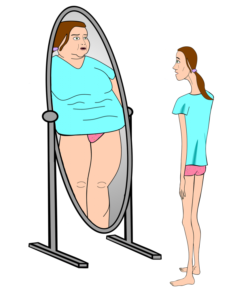 Treatment for Eating Disorders