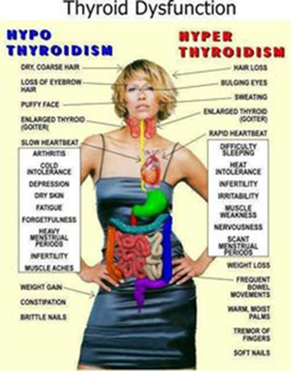 Thyroid Disorders and Natural remedies for thyroid problems