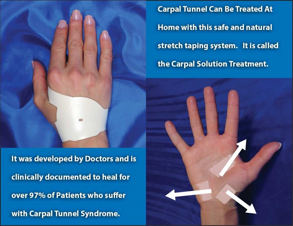 Natural treatment for carpal tunnel syndrome