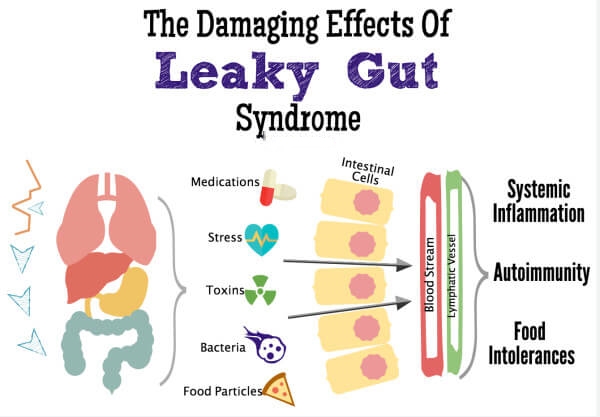 Leaky gut pathology - Philadelphia Holistic Clinic
