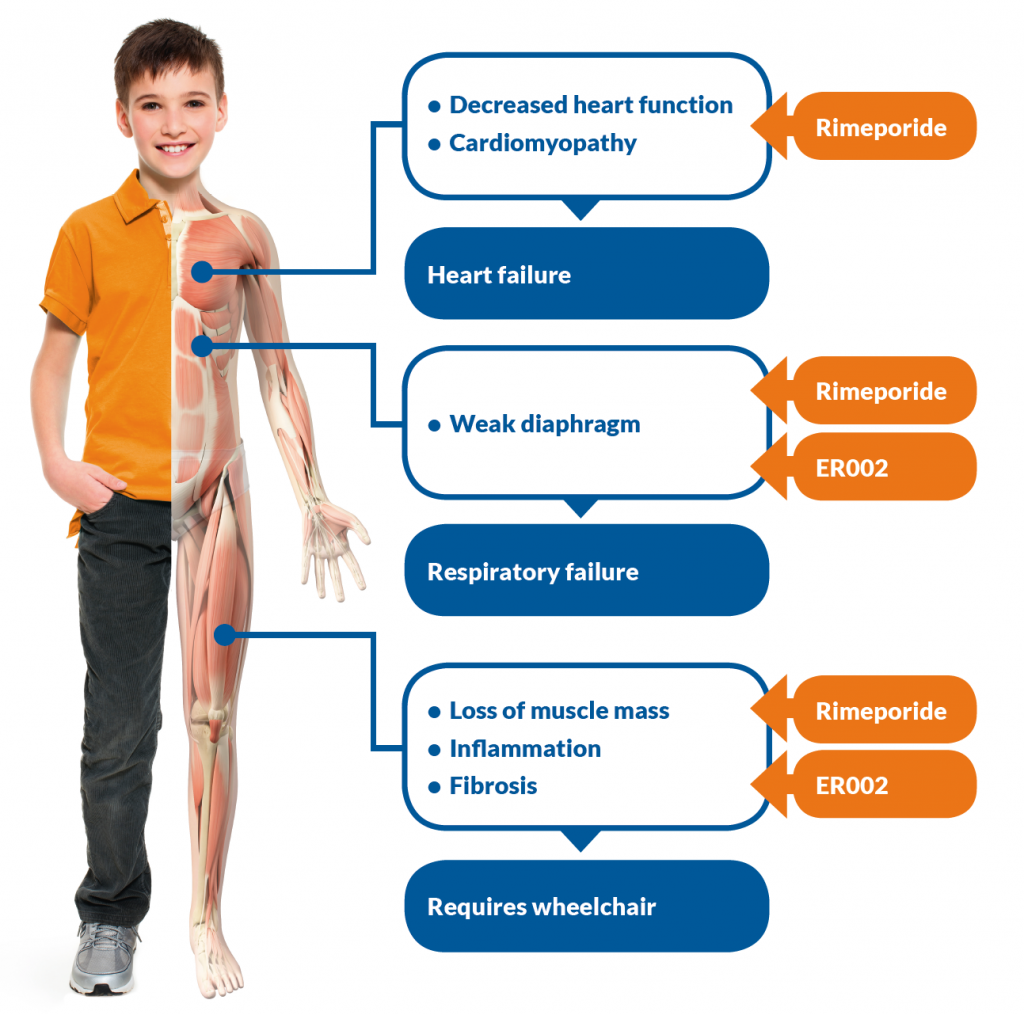 Muscular Dystrophy Duchene Philadelphia Holistic Clinic