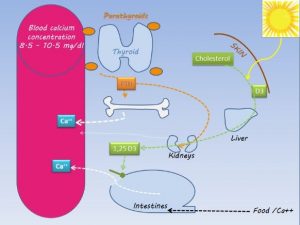 hyperparathyroidism