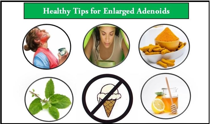 Natural treatment for adenoids