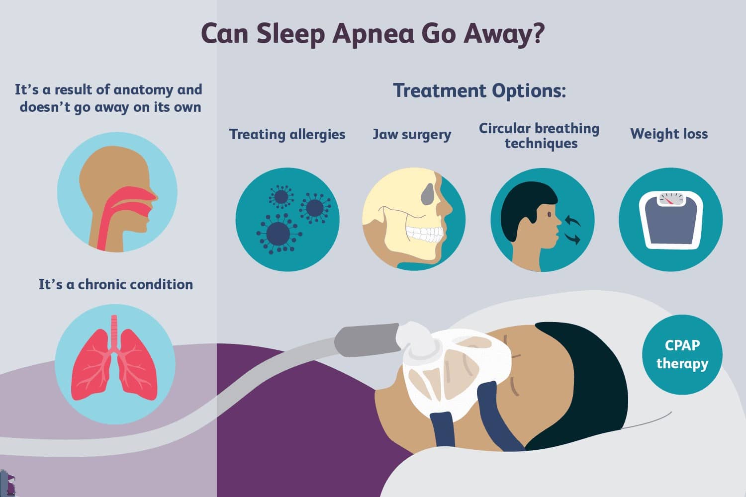 New Treatments For Sleep Apnea 2025 - Lucky Rozina