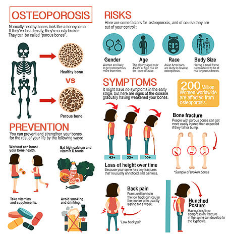 Natural Treatment For Osteoporosis Philadelphia Holistic Clinic Dr Tsan