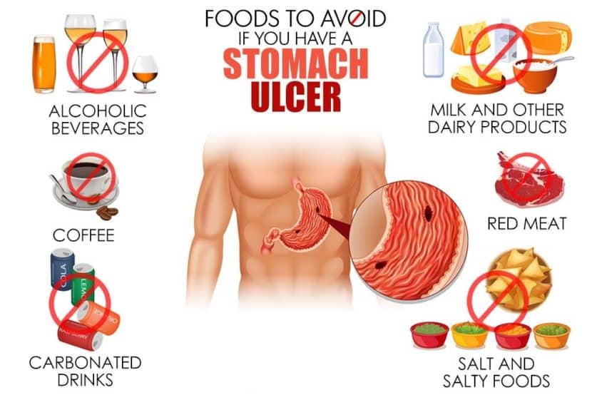 Natural treatment for stomach ulcers - Philadelphia Holistic Clinic 