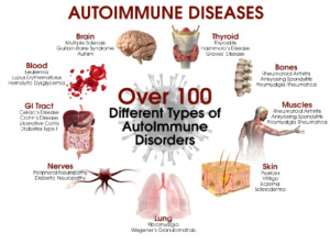 Natural Treatment of Autoimmune Diseases