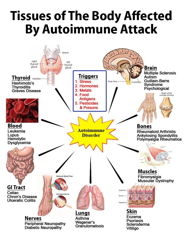 Symptoms of autoimmune diseases