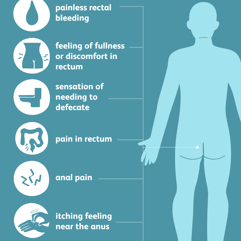 Hemorrhoids symptoms and Treatment for Hemorrhoids