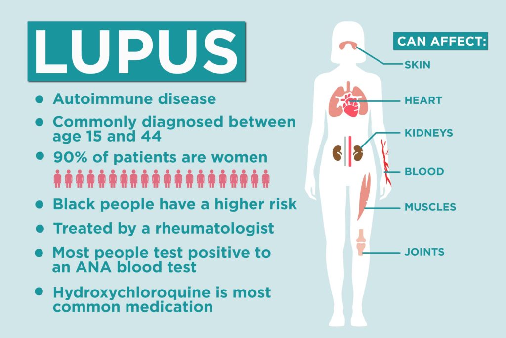 Lupus - Autoimmune disease