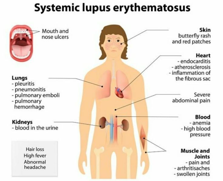 Symptoms of erythematosus