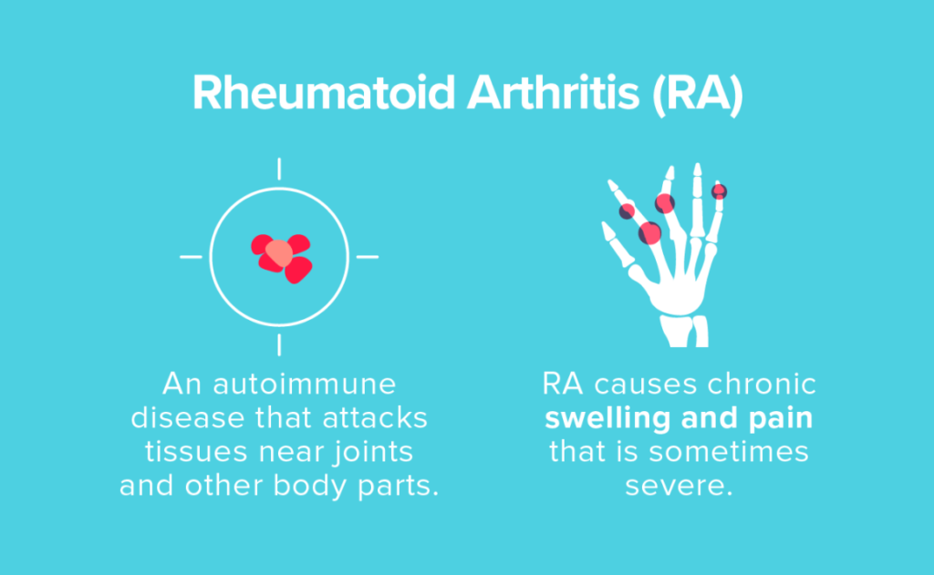 Treatment for Rheumatoid Arthritis