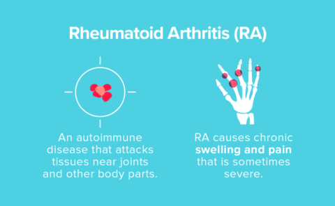 Treatment for Rheumatoid Arthritis - Philadelphia Holistic Clinic - Dr ...