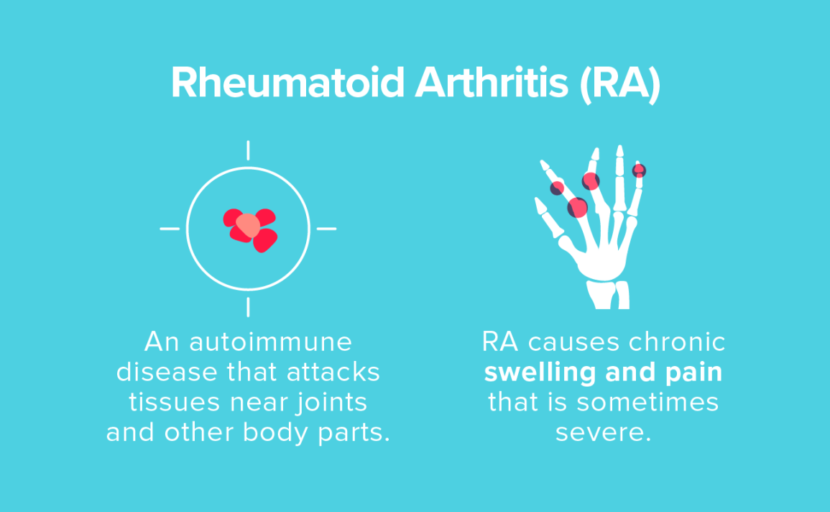 Treatment for Rheumatoid Arthritis Philadelphia Holistic Clinic Dr