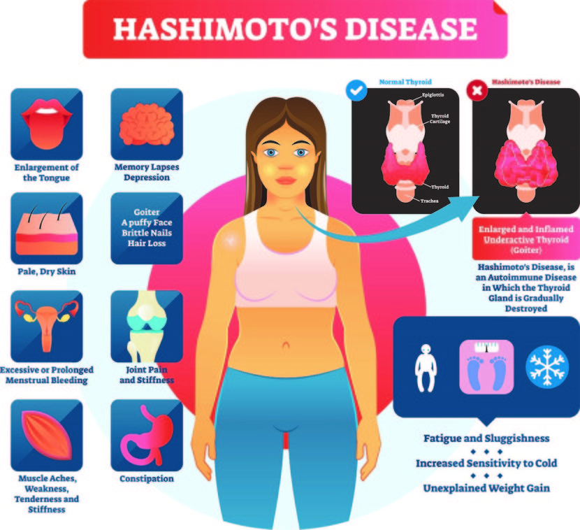 thyroid-part-1-thyroid-function-test-thyroid-hormones-t4-t3-tsh