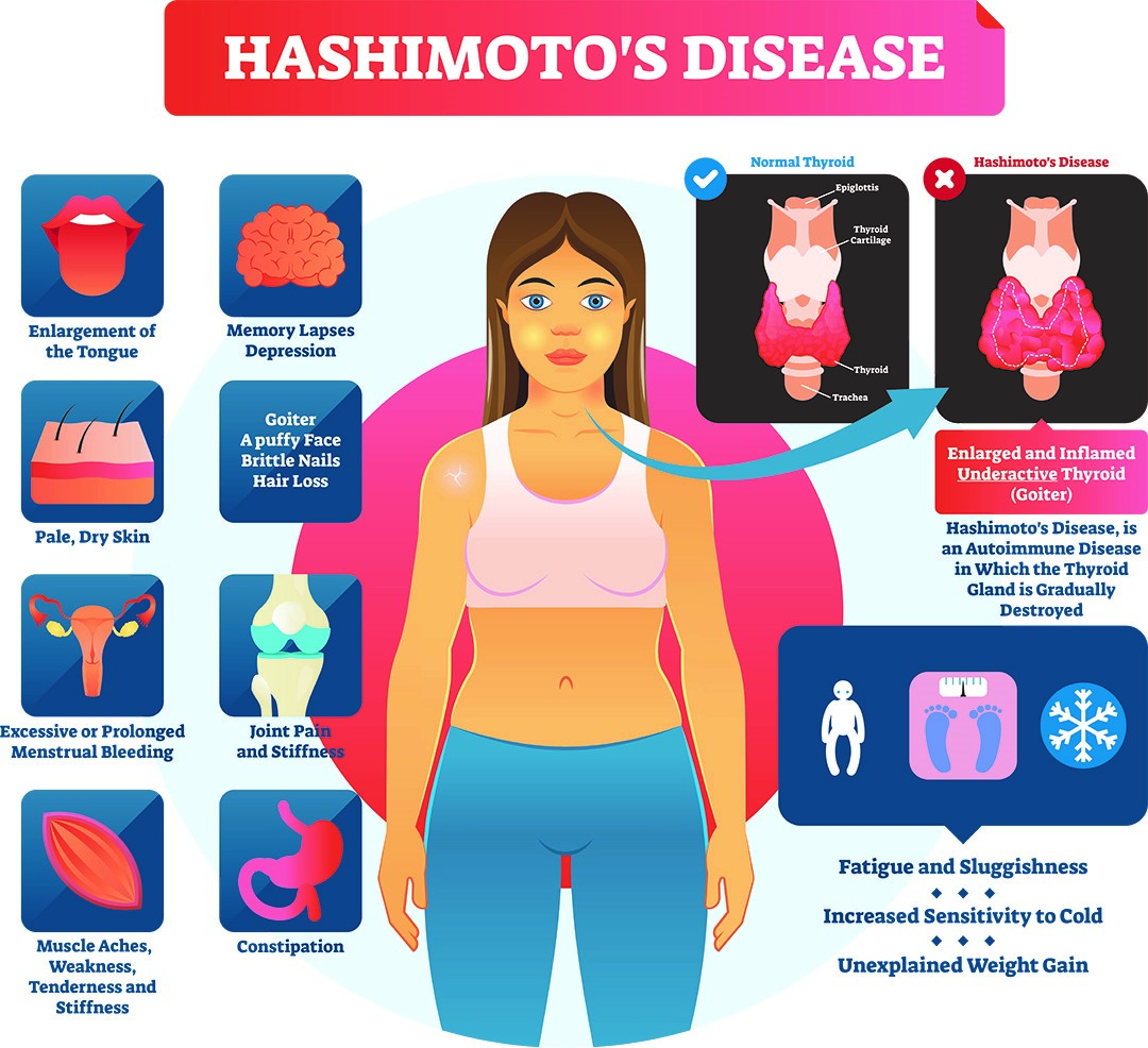 Causes of halitosis 