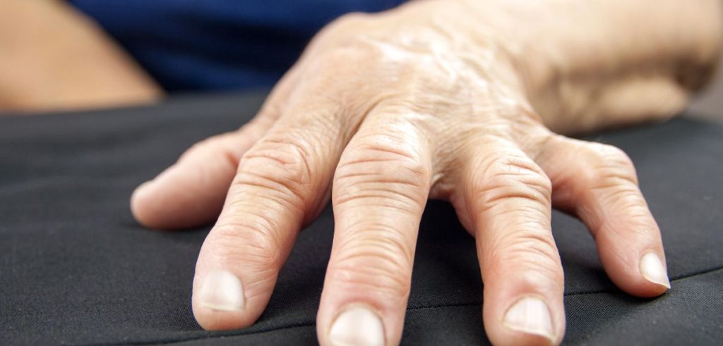Natural Treatment for Rheumatoid Arthritis