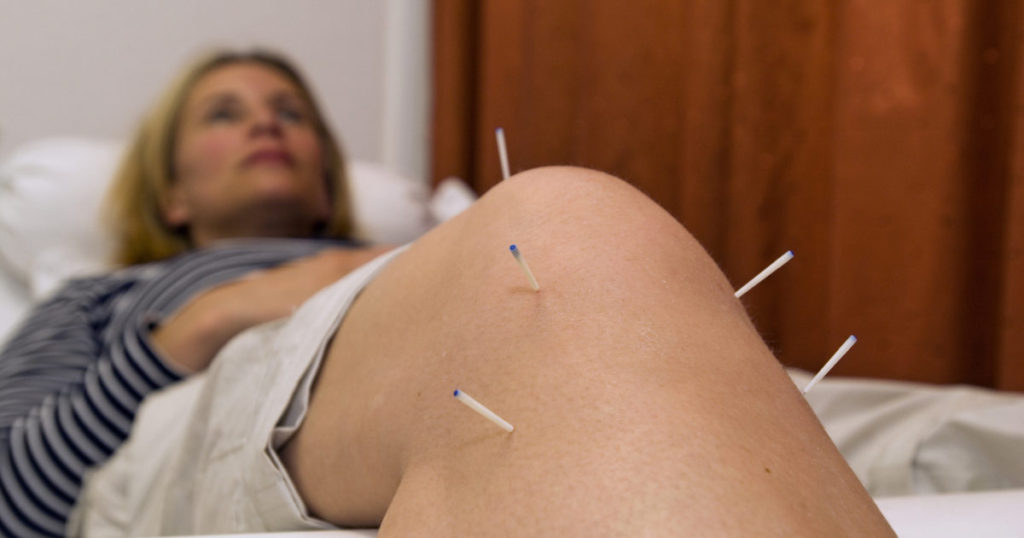 Acupuncture for joint pain is more effective than TENS