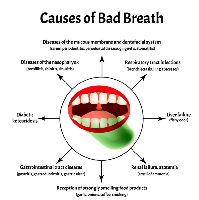 what is causing halitosis