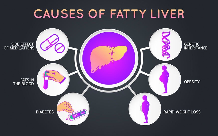 Causes of fatty liver