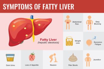 Fatty liver symptoms - Philadelphia Holistic Clinic