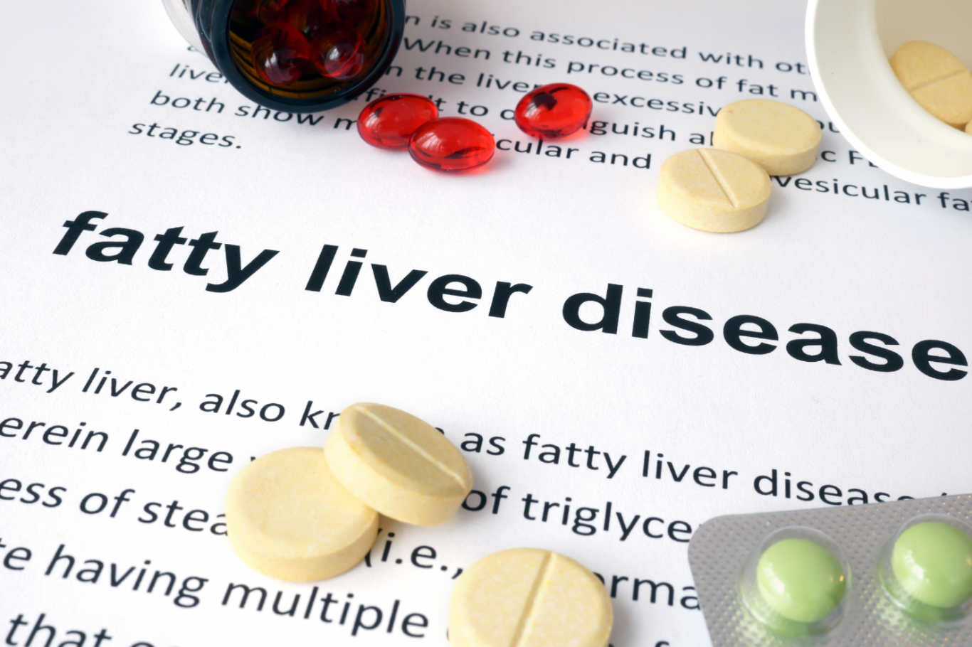 what-should-you-be-eating-if-you-have-a-fatty-liver-liver-doctor