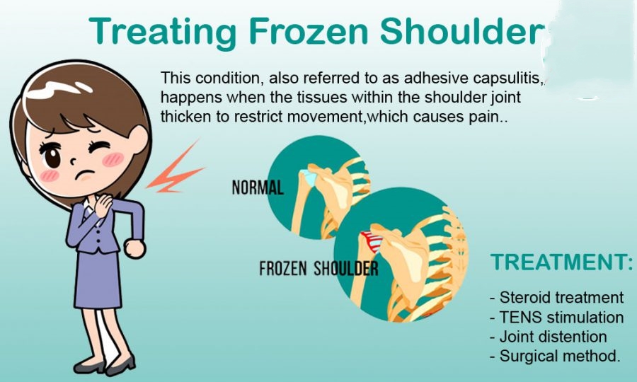 Treatment for Frozen Shoulder Philadelphia Holistic Clinic Dr Tsan