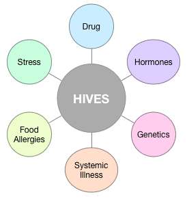 Causes of Hives