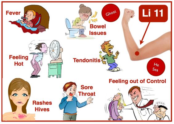 Acupuncture for Urticaria