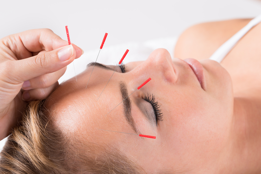 acupuncture for seasonal allergies