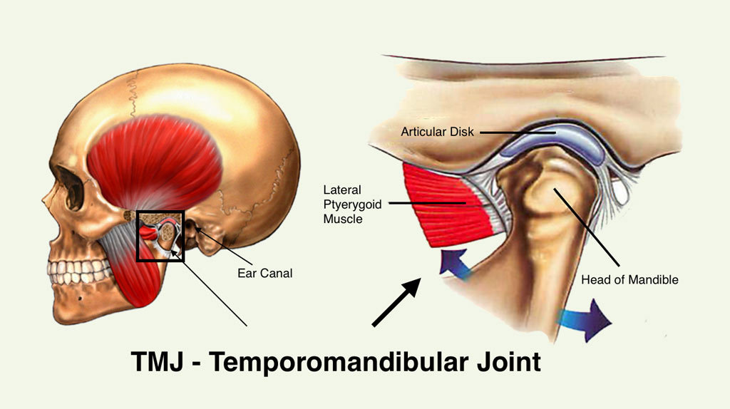 What is TMJ disorder