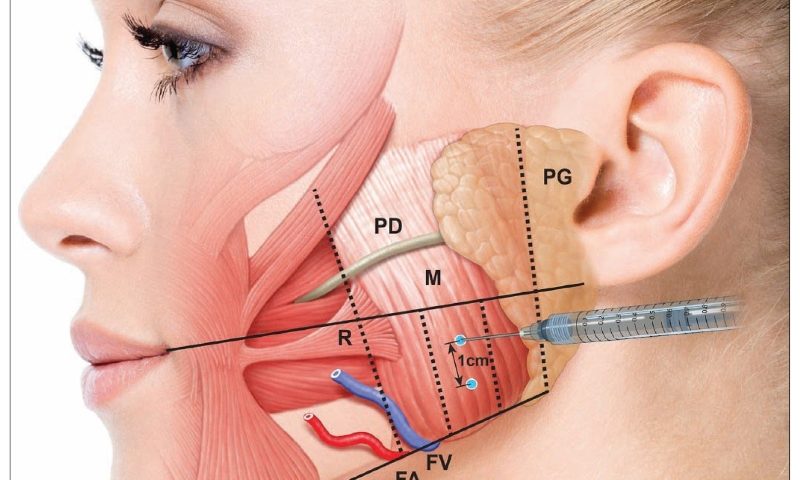 Treatment for TMJ