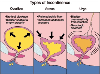 Types of enuresis