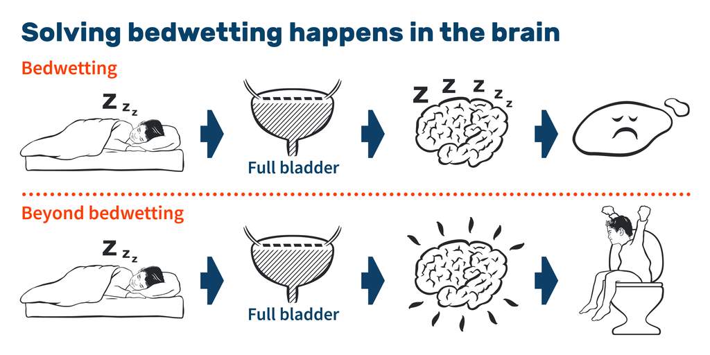 Urinary Incontinence - Bedwetting