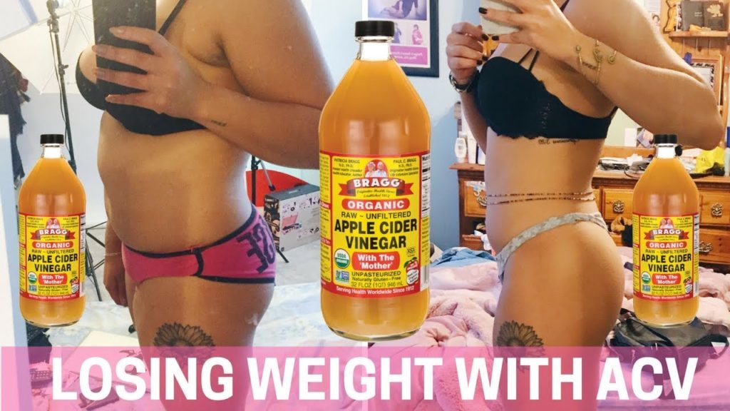 Apple Cider Vinegar for weight loss