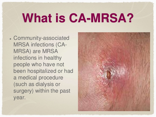 MRSA (staph) infection