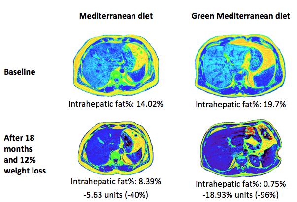 Mediterranean Diet and Greens