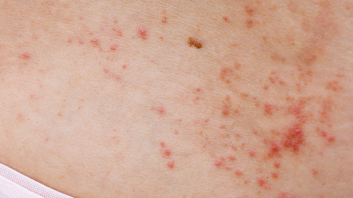 pinpoint red spots on skin