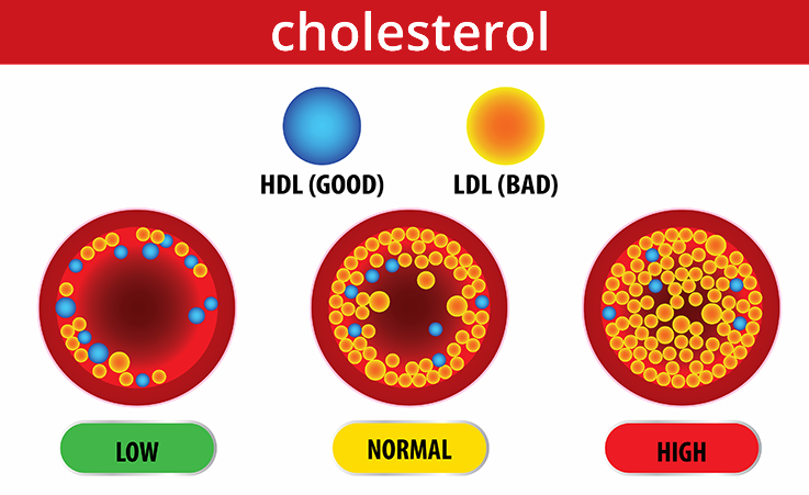 Cholesterol General 1 - Philadelphia Holistic Clinic