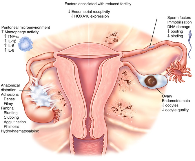 Possible fertility issues