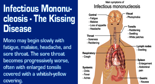 symptoms of mono in adults