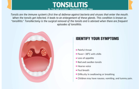 Treatment Of Tonsillitis - Philadelphia Holistic Clinic - Dr. Tsan ...